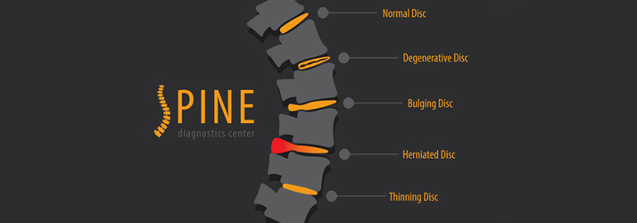 Chiropractic Ashland OH Spine Blog